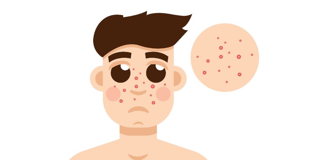 Age Spots in Men: Causes & Skincare | VMEN’S