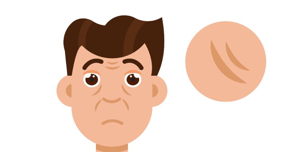 Large Pores in Men: Causes & Care | VMEN’S